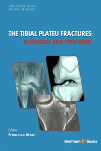 The Tibial Plateau Fractures: Diagnosis and Treatment_cover
