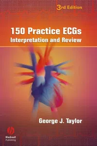 150 Practice ECGs_cover