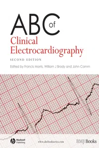ABC of Clinical Electrocardiography_cover