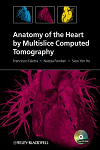 Anatomy of the Heart by Multislice Computed Tomography_cover