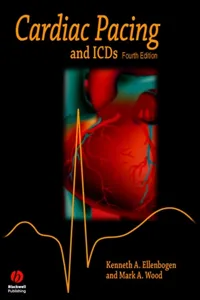 Cardiac Pacing and ICDs_cover