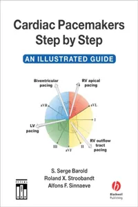 Cardiac Pacemakers Step by Step_cover