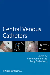 Central Venous Catheters_cover