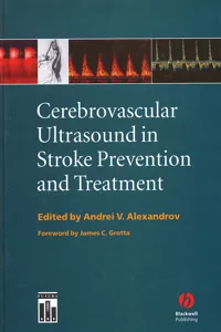 Cerebrovascular Ultrasound in Stroke Prevention and Treatment_cover