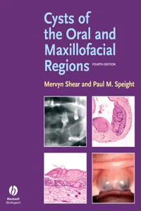 Cysts of the Oral and Maxillofacial Regions_cover