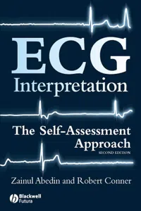 ECG Interpretation_cover