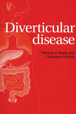 Diverticular Disease