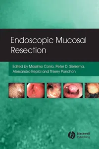 Endoscopic Mucosal Resection_cover