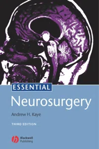 Essential Neurosurgery_cover