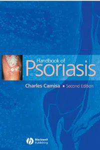 Handbook of Psoriasis_cover