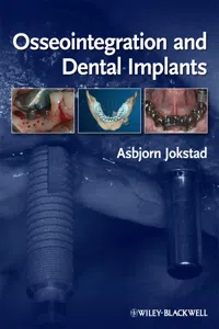 Osseointegration and Dental Implants_cover