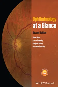 Ophthalmology at a Glance_cover