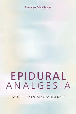 Epidural Analgesia in Acute Pain Management