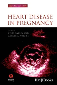 Heart Disease in Pregnancy_cover