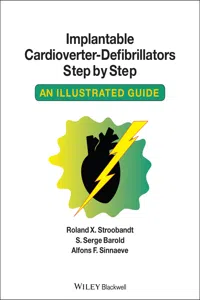 Implantable Cardioverter - Defibrillators Step by Step_cover