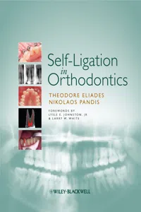 Self-Ligation in Orthodontics_cover