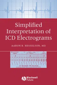 Simplified Interpretation of ICD Electrograms_cover