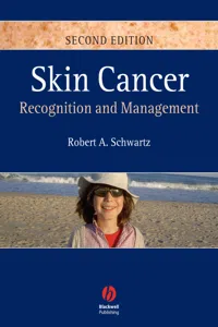 Skin Cancer_cover