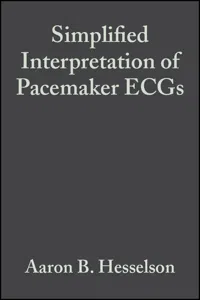 Simplified Interpretation of Pacemaker ECGs_cover