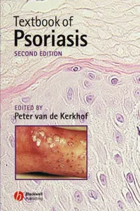 Textbook of Psoriasis_cover