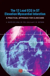 The 12 Lead ECG in ST Elevation Myocardial Infarction_cover