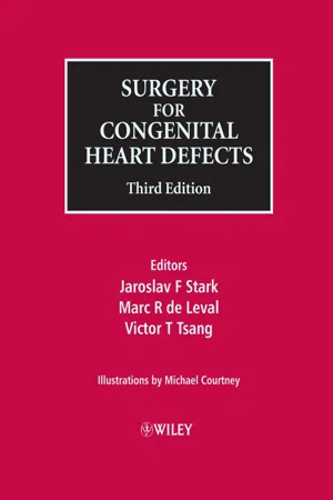 Surgery for Congenital Heart Defects