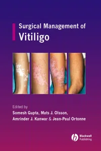 Surgical Management of Vitiligo_cover