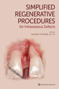 Simplified Regenerative Procedures for Intraosseous Defects_cover