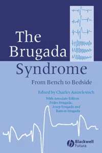 The Brugada Syndrome_cover