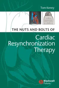 The Nuts and Bolts of Cardiac Resynchronization Therapy_cover