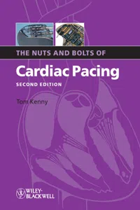 The Nuts and Bolts of Cardiac Pacing_cover