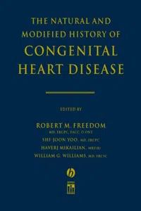 The Natural and Modified History of Congenital Heart Disease_cover