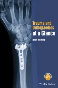 Trauma and Orthopaedics at a Glance_cover