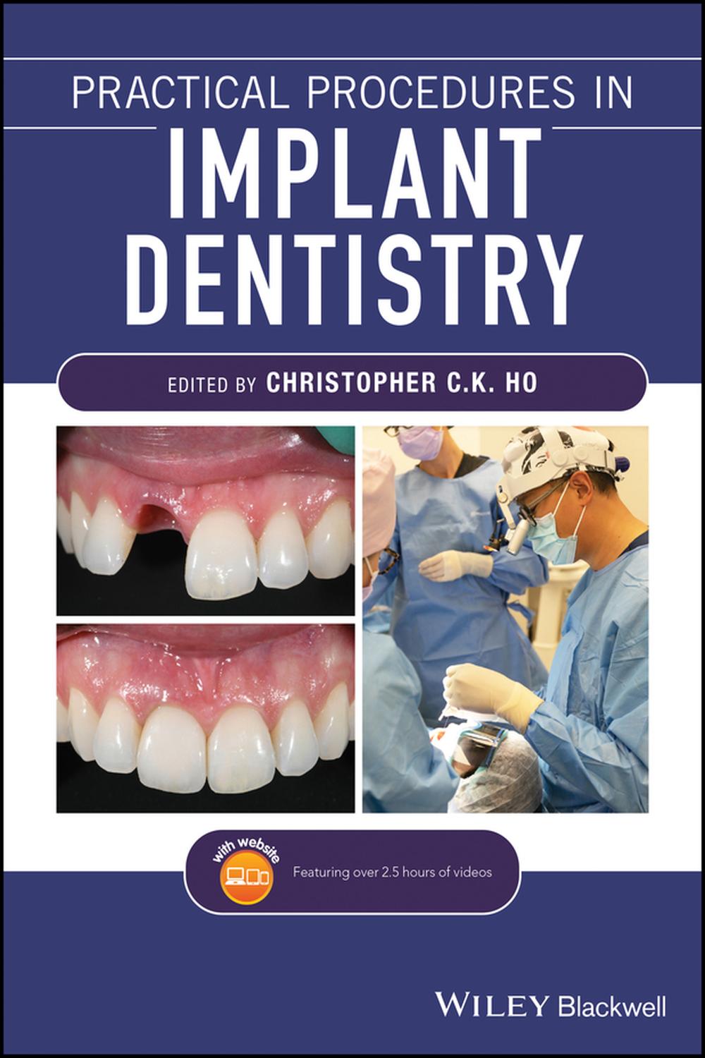 PDF] Practical Procedures in Implant Dentistry by Christopher