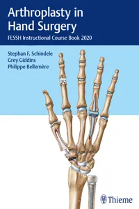 Arthroplasty in Hand Surgery_cover