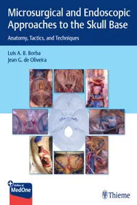 Microsurgical and Endoscopic Approaches to the Skull Base_cover
