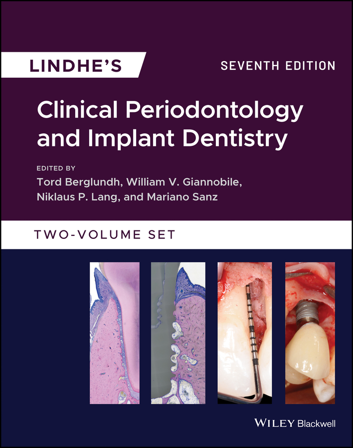 PDF] Lindhe's Clinical Periodontology and Implant Dentistry by