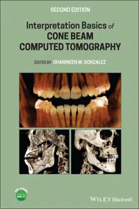 Interpretation Basics of Cone Beam Computed Tomography_cover