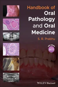 Handbook of Oral Pathology and Oral Medicine_cover