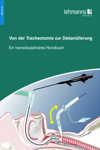 Von der Tracheotomie zur Dekanülierung_cover