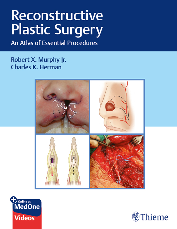 PDF] Reconstructive Plastic Surgery by Robert X. Murphy Jr