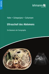 Ultraschall des Abdomens_cover
