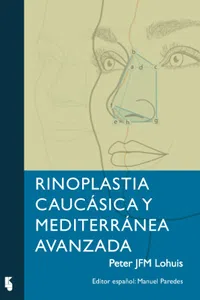 Rinoplastia Caucásica y Mediterr ánea Avanzada_cover