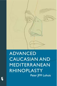 Advanced Caucasian and Mediterranean Rhinoplasty