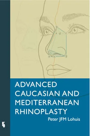 Advanced Caucasian and Mediterranean Rhinoplasty
