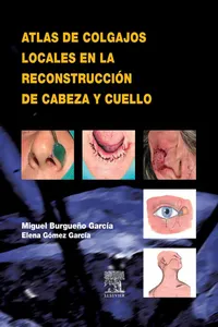 Atlas de colgajos locales en la reconstrucción de cabeza y cuello_cover