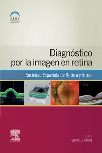 Diagnóstico por la imagen en retina_cover