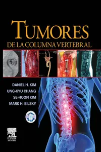 Tumores de la columna vertebral_cover