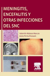 Meningitis, encefalitis y otras infecciones del SNC_cover