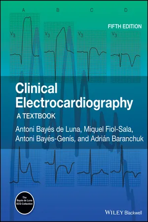 Clinical Electrocardiography